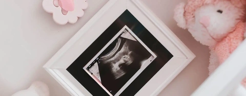 2023 Sonogram Frame Review: Choose Perfect Baby Keepsake & Decor